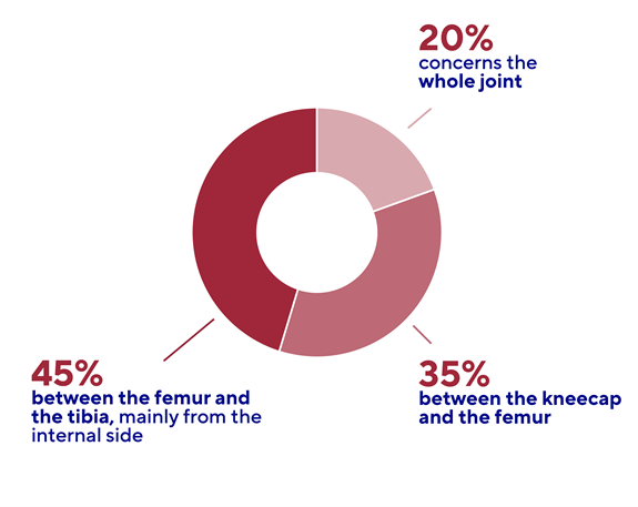 Chart of the types of osteoarthritis